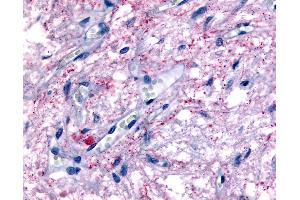 Anti-GPR50 antibody IHC of human pituitary.