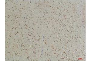 Immunohistochemistry (IHC) analysis of paraffin-embedded Mouse Brain Tissue using GABA Transporter 1 Rabbit Polyclonal Antibody diluted at 1:200.