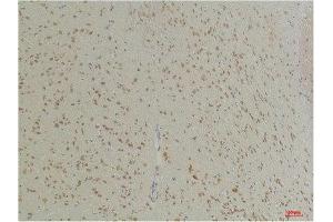 Immunohistochemistry (IHC) analysis of paraffin-embedded Mouse Brain Tissue using GABA Transporter 1 Rabbit Polyclonal Antibody diluted at 1:200. (SLC6A1 anticorps)