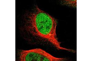 Immunofluorescent staining of U-2 OS with MCM3 polyclonal antibody  (Green) shows positivity in centrosome and nucleus but excluded from the nucleoli. (MCM3 anticorps)