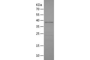Western Blotting (WB) image for Transforming, Acidic Coiled-Coil Containing Protein 3 (TACC3) (AA 390-689) protein (His tag) (ABIN7125462)