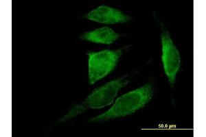Immunofluorescence of purified MaxPab antibody to TMSB4X on HeLa cell. (TMSB4X anticorps  (AA 1-44))