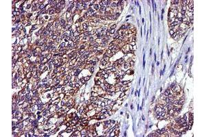 Image no. 1 for anti-LIM Domain Kinase 1 (LIMK1) antibody (ABIN1499147)