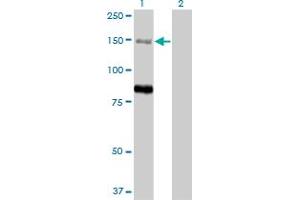 Western Blot analysis of MTMR3 expression in transfected 293T cell line by MTMR3 monoclonal antibody (M07A), clone 1E11. (MTMR3 anticorps  (AA 579-674))