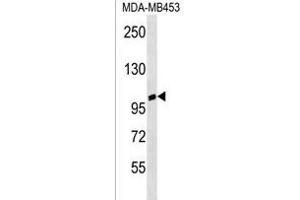 ANKRD20A3 Antibody (C-term) (ABIN1537600 and ABIN2850333) western blot analysis in MDA-M cell line lysates (35 μg/lane). (ANKRD20A3 anticorps  (C-Term))