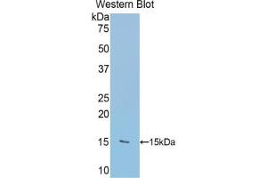 Detection of Recombinant RALBP1, Human using Polyclonal Antibody to RalA Binding Protein 1 (RALBP1) (RALBP1 anticorps  (AA 403-499))