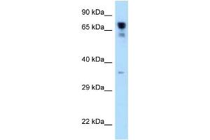 WB Suggested Anti-RARS Antibody Titration: 1. (RARS anticorps  (C-Term))