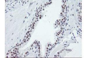 Image no. 8 for anti-SUMO1/sentrin/SMT3 Specific Peptidase 2 (SENP2) (AA 139-523) antibody (ABIN1490925)