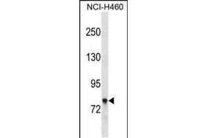 Western blot analysis in NCI-H460 cell line lysates (35ug/lane). (Amphiphysin anticorps  (AA 140-168))