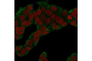 Immunofluorescence Analysis of human MCF-7 cells labeling GPI with GPI Mouse Monoclonal Antibody (CPTC-GPI-1) followed by Goat anti-Mouse IgG-CF488 (Green). (GPI anticorps)