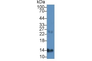 Detection of CXCL7 in Human Liver lysate using Monoclonal Antibody to Chemokine (C-X-C motif) ligand 7 ( CXCL7) (CXCL7 anticorps  (AA 59-128))