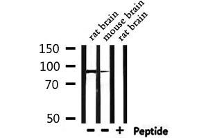 Western blot analysis of extracts from rat rain,mouse brain , using USP13 Antibody.