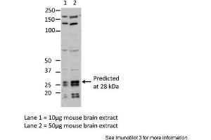 Sample Type: Lane1 = 10ug mouse brain extractLane 2 = 50ug mouse brain extractPrimary Antibody Dilution: Anti-EIF4E 1:1000Submitted By: Dr. (EIF4E anticorps  (C-Term))