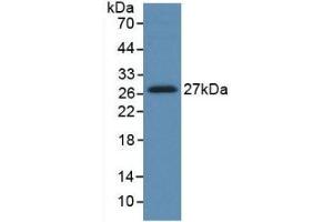 Detection of Recombinant HGF, Human using Monoclonal Antibody to Hepatocyte Growth Factor (HGF)