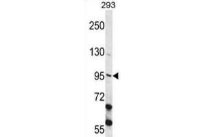 Western Blotting (WB) image for anti-Epithelial Cell Transforming Sequence 2 Oncogene (ECT2) antibody (ABIN2998212) (ECT2 anticorps)