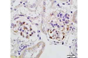 Formalin-fixed and paraffin embedded rat kidney tissue with Anti-Megsin Polyclonal Antibody, Unconjugated  at 1:200, followed by conjugation to the secondary antibody and DAB staining (SERPINB7 anticorps  (AA 301-380))