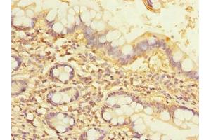Immunohistochemistry of paraffin-embedded human small intestine tissue using ABIN7161966 at dilution of 1:100