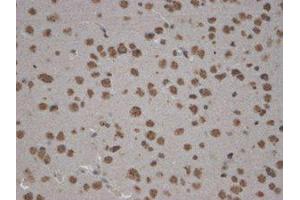 Zinedin Immunohistochemistry.
