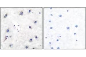 Immunohistochemistry analysis of paraffin-embedded human brain tissue, using DARPP-32 (Ab-34) Antibody. (DARPP32 anticorps  (AA 18-67))