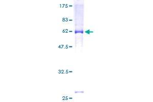 Image no. 1 for Potassium Voltage-Gated Channel, KQT-Like Subfamily, Member 2 (KCNQ2) (AA 1-393) protein (GST tag) (ABIN1308479)