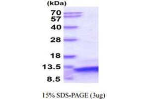 SDS-PAGE (SDS) image for Parathyroid Hormone (PTH) protein (ABIN666842) (PTH Protéine)
