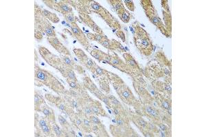 Immunohistochemistry of paraffin-embedded human liver using FUT6 antibody (ABIN5972052) at dilution of 1/100 (40x lens).