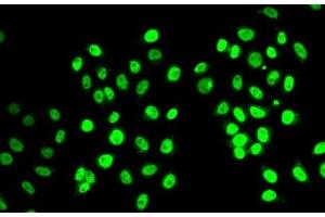 Immunofluorescence analysis of MCF-7 cells using REST Polyclonal Antibody (REST anticorps)
