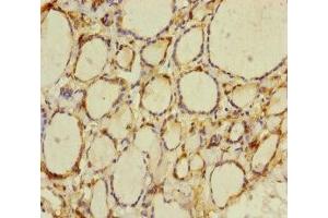Immunohistochemistry of paraffin-embedded human thyroid tissue using ABIN7165198 at dilution of 1:100 (CRBN anticorps  (AA 1-280))