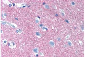 Human Brain, Cortex (formalin-fixed, paraffin-embedded) stained with NCAM1 antibody ABIN239830 at 10 µg/ml followed by biotinylated anti-mouse IgG secondary antibody ABIN481714, alkaline phosphatase-streptavidin and chromogen. (CD56 anticorps)