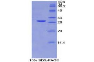 SDS-PAGE analysis of Mouse GSTm2 Protein. (GSTM2 Protéine)