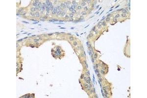 Immunohistochemistry of paraffin-embedded Human prostate using GPI Polyclonal Antibody at dilution of 1:100 (40x lens). (GPI anticorps)