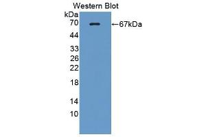 Western blot analysis of the recombinant protein. (Lactate Dehydrogenase A anticorps  (AA 1-332))