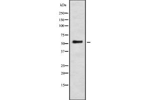 Western blot analysis IFI-56K using LOVO whole cell lysates (IFIT1 anticorps  (Internal Region))