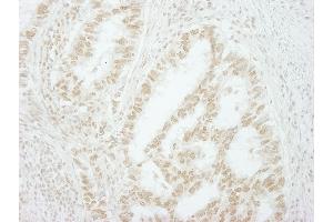 Immunohistochemistry (IHC) image for anti-Makorin Ring Finger Protein 2 (MKRN2) (C-Term) antibody (ABIN7448671)