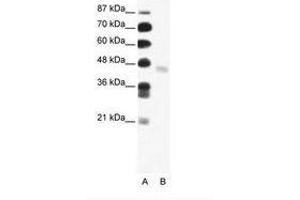 Image no. 1 for anti-FEZ Family Zinc Finger 2 (FEZF2) (N-Term) antibody (ABIN202569) (FEZF2 anticorps  (N-Term))