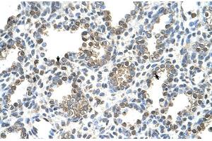 Rabbit Anti-TST Antibody  Paraffin Embedded Tissue: Human Lung Cellular Data: Alveolar cells Antibody Concentration: 4.