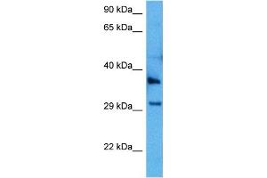 Host:  Mouse  Target Name:  GJB1  Sample Tissue:  Mouse Spleen  Antibody Dilution:  1ug/ml (GJB1 anticorps  (C-Term))