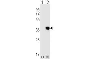 Western blot analysis of HLA-G antibody and 293 cell lysate either nontransfected (Lane 1) or transiently transfected (2) with the HLA-G gene. (HLAG anticorps  (AA 62-89))