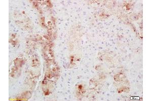 Formalin-fixed and paraffin embedded mouse thyroid labeled with Anti-Secretin receptor Polyclonal Antibody, Unconjugated (ABIN724730) at 1:200 followed by conjugation to the secondary antibody and DAB staining (SCTR anticorps  (AA 188-280))