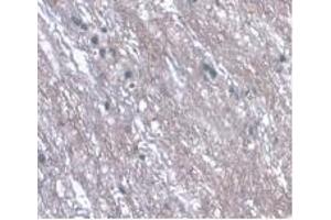 Detection of LRG1 in Rat Spinal Cord Tissue using Monoclonal Antibody to Leucine Rich Alpha-2-Glycoprotein 1 (LRG1) (LRG1 anticorps  (AA 154-332))