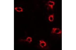 Immunofluorescent analysis of ACP5 staining in U2OS cells.