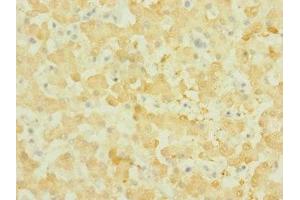 Immunohistochemistry of paraffin-embedded human liver tissue using ABIN7161009 at dilution of 1:100 (NOX3 anticorps  (AA 223-395))