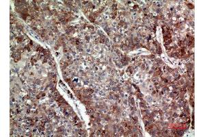 Immunohistochemistry (IHC) analysis of paraffin-embedded Human Lung, antibody was diluted at 1:100. (IL-24 anticorps  (Internal Region))