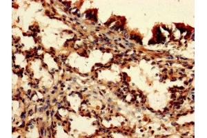 IHC image of ABIN7149549 diluted at 1:150 and staining in paraffin-embedded human lung tissue performed on a Leica BondTM system. (DAP anticorps  (AA 2-102))