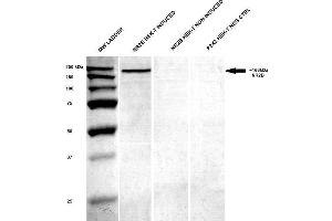 Western Blot analysis of Human HEK-T lysates showing detection of GluN2B/NR2B protein using Mouse Anti-GluN2B/NR2B Monoclonal Antibody, Clone S59-36 . (GRIN2B anticorps  (AA 20-271) (APC))
