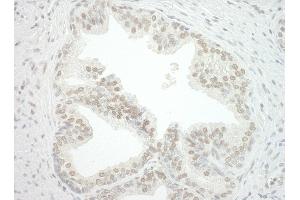 anti-Chromobox Homolog 7 (CBX7) (AA 201-251) antibody