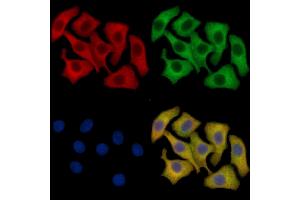 Fas Ligand Mouse Monoclonal Antibody staining HepG2 cells by IF/ICC. (FASL anticorps  (Internal Region))
