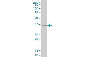 SIX3 monoclonal antibody (M04), clone 1A2 Western Blot analysis of SIX3 expression in 293 . (SIX3 anticorps  (AA 273-332))