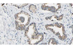 ABIN6268698 at 1/100 staining Human prostate tissue by IHC-P. (CD51 anticorps  (Internal Region))