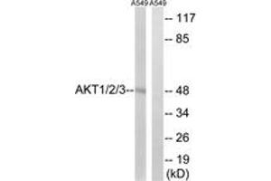 Western blot analysis of extracts from A549 cells, using AKT1/2/3 (Ab-315/316/312) Antibody. (AKT 1/2/3 anticorps  (AA 281-330))